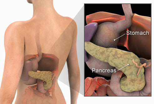 cancer de pancreas