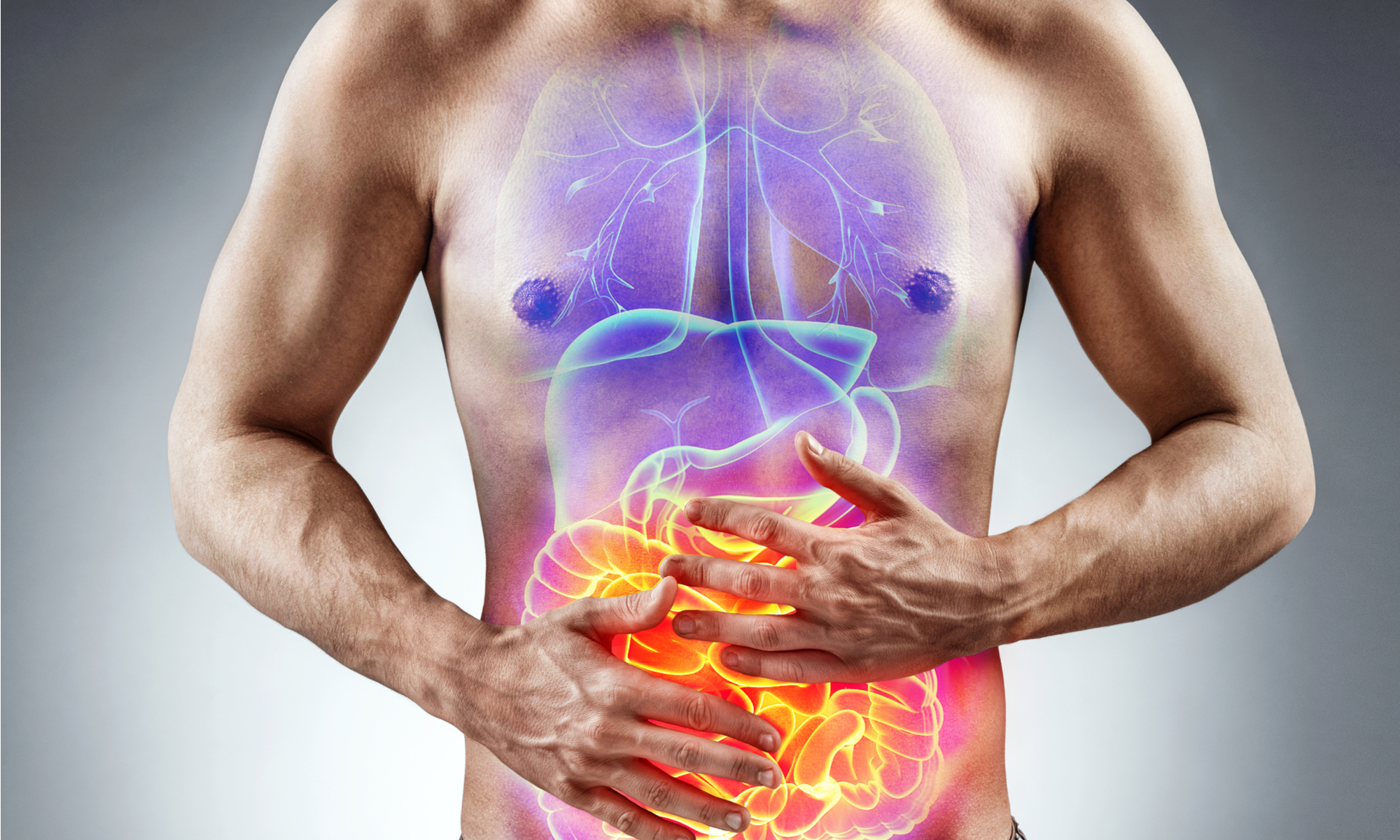 intestino irritable